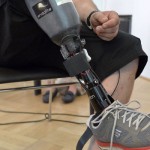 El médico austriaco ya había innovado en 2010 al presentar una prótesis de brazo controlada por la mente.