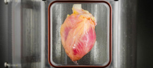 El avance también permitiría usar parches cardíacos que puedan sustituir áreas de tejido dañadas por un infarto