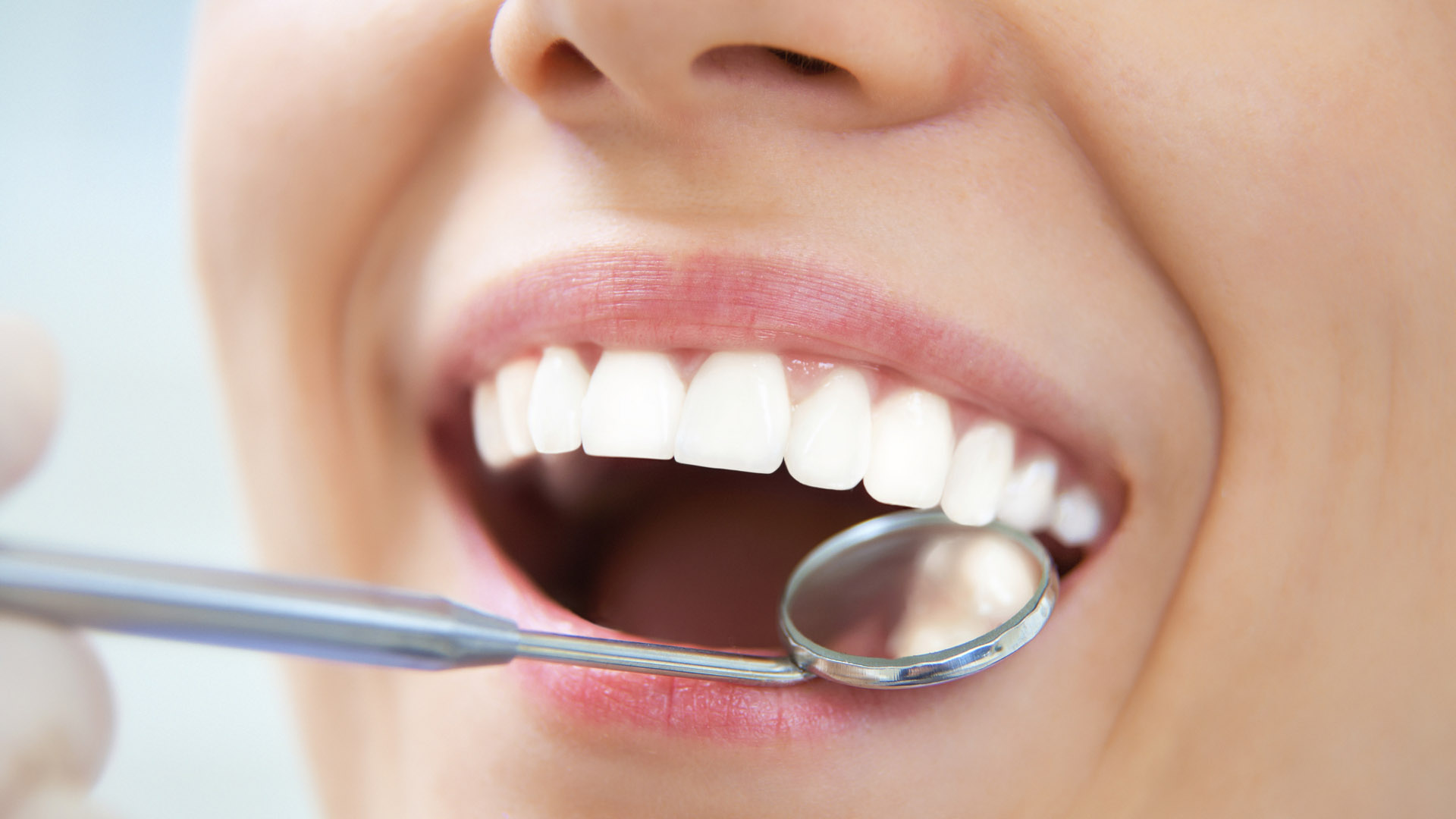 Acudir al dentistas 2 veces por año es lo más recomendado para la salud dental, esto y dejar esos malos hábitos te haran lucir dientes de revista