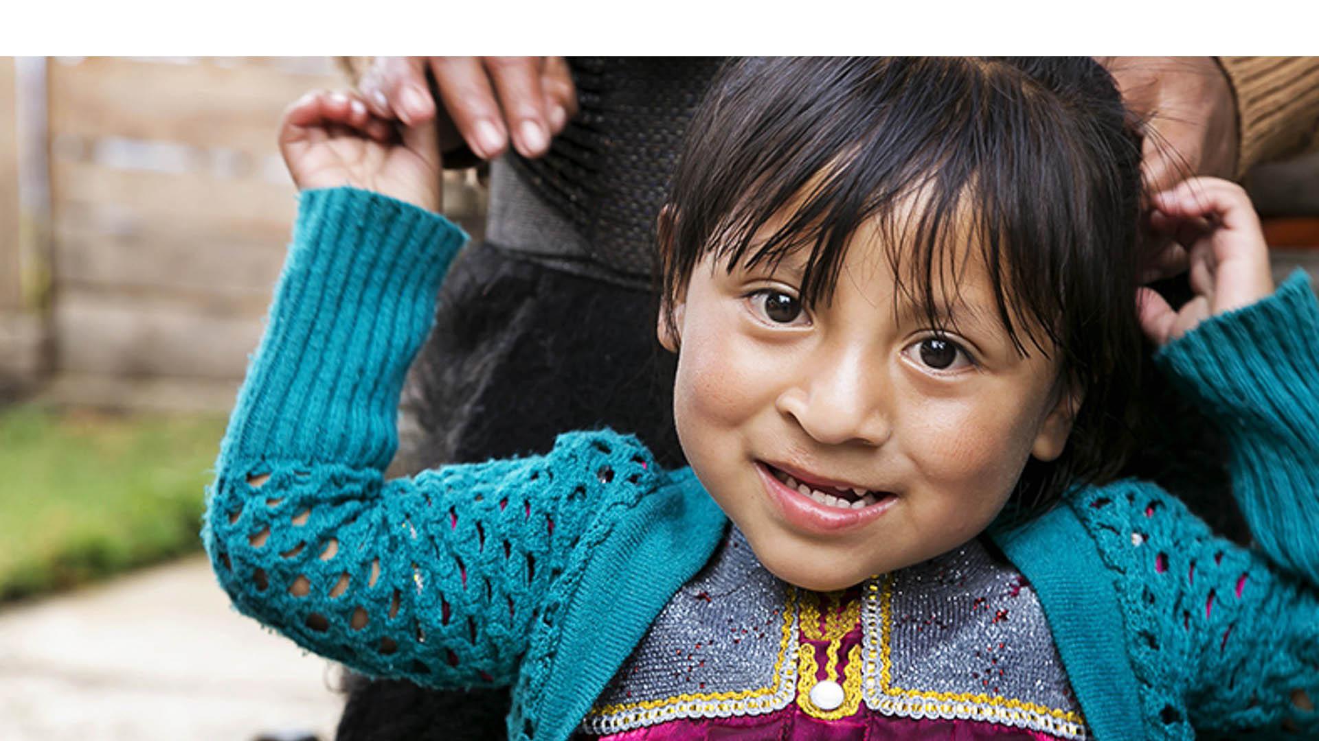 El programa Conduciendo Sonrisas busca atender a niños con este defecto en el estado Sucre