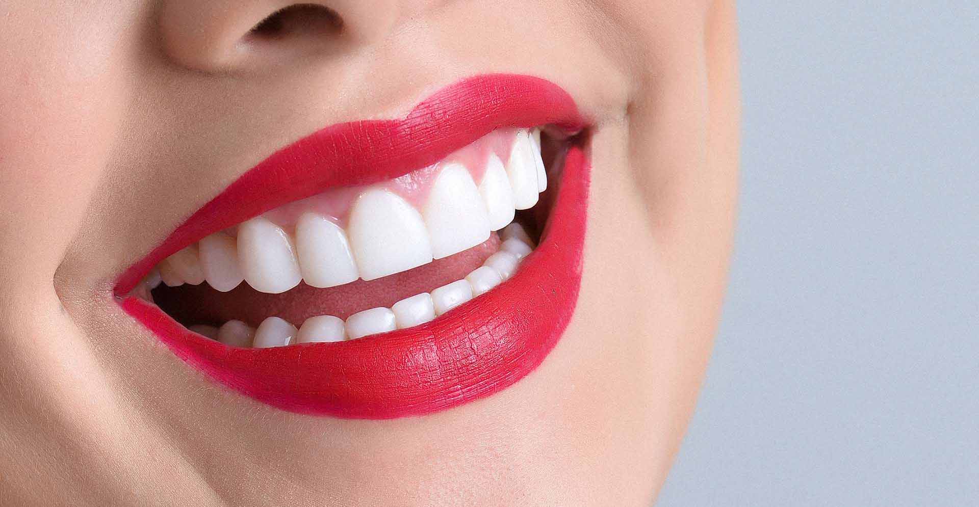 Lo más importante de una buena sonrisa es tener la salud bucal intacta por eso sigue las indicaciones y muestra tus dientes con gusto