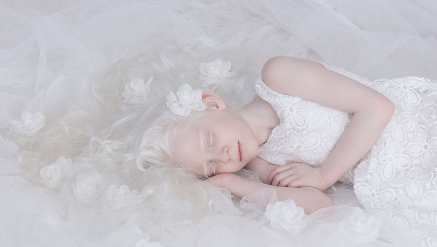 "Belleza de porcelana" es el proyecto creativo de la fotógrafa israelí Yulia Taits en donde retrata a las personas albinas