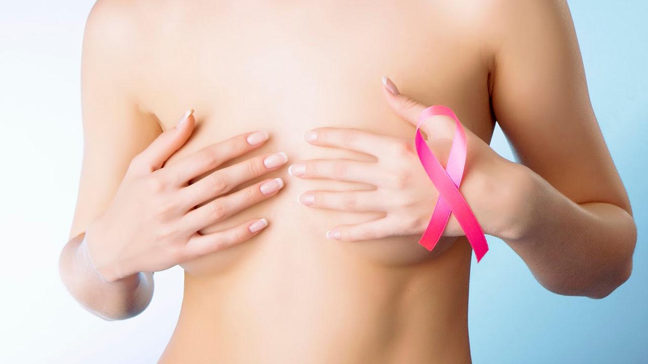 SAV tiene evento para evitar el cáncer de mama