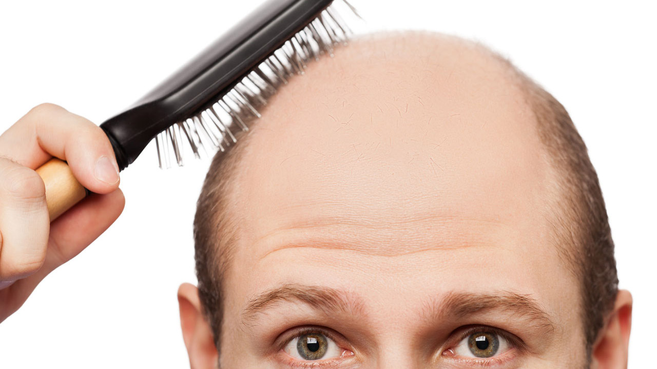 Los expertos realizarán ensayos clínicos con dupilumab en pacientes que tengan alopecia