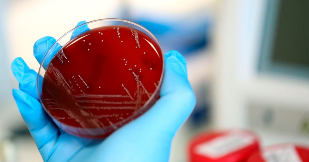 Siguen aumentando los casos de coronavirus en el mundo