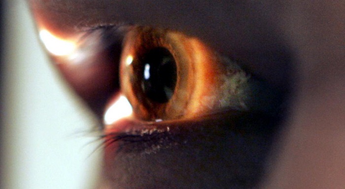 Una investigación demostró que el EPR de cadáveres donados pudo adaptarse bien en ojos de primates sin tener efectos secundarios graves