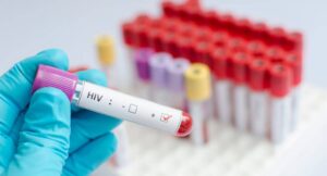  Aprueban la primera inyección para el tratamiento del VIH-1