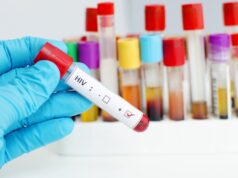 El Sumario - Universidad de Oxford inicia ensayos de la vacuna contra el VIH