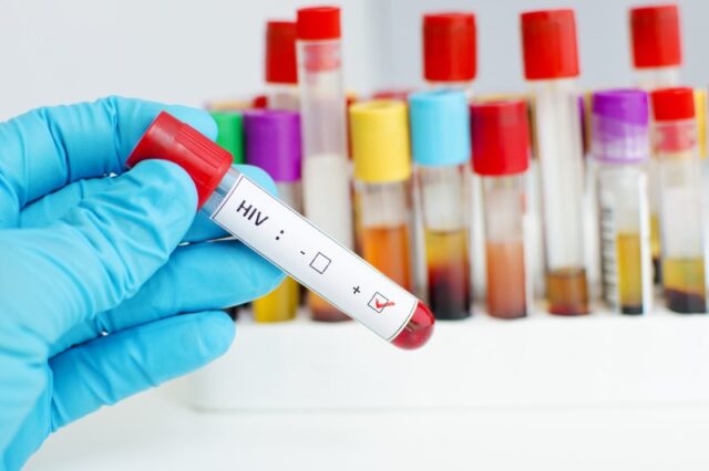 El Sumario - Universidad de Oxford inicia ensayos de la vacuna contra el VIH