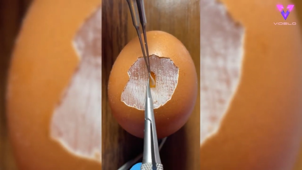 El Sumario - Estudiante de medicina practica sus habilidades con todo tipo de alimentos frescos