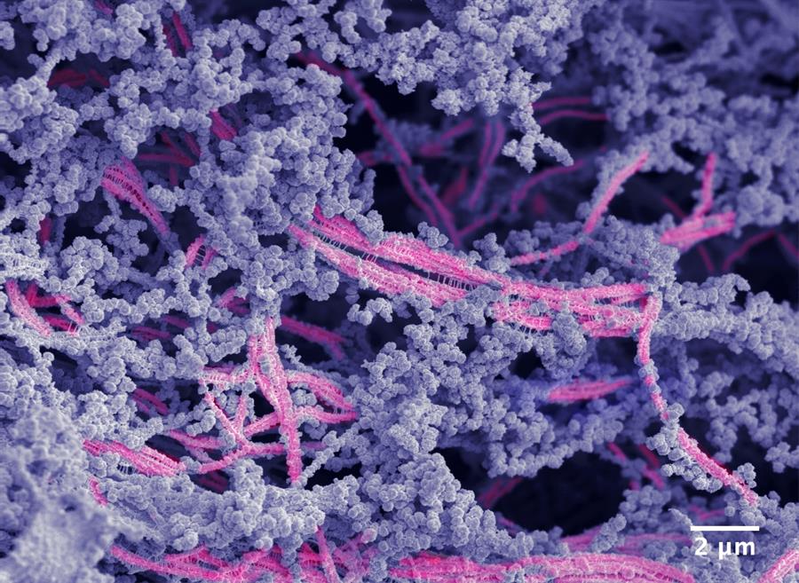 biomaterial
