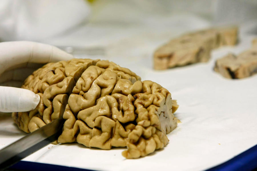 cerebro
