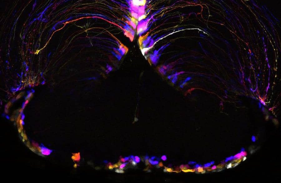 cerebro