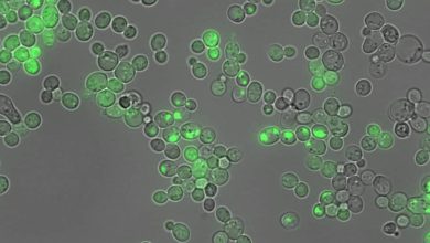Proteínas - alzheimer