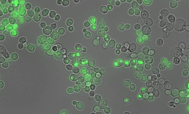 Proteínas - alzheimer