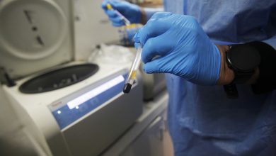 VIH - Laboratorio