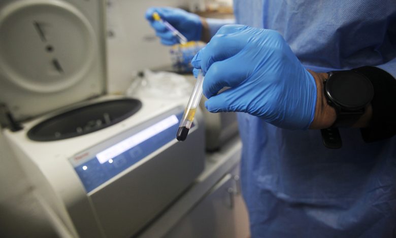 VIH - Laboratorio