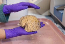 Cerebro