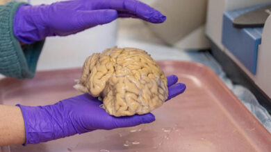 Cerebro