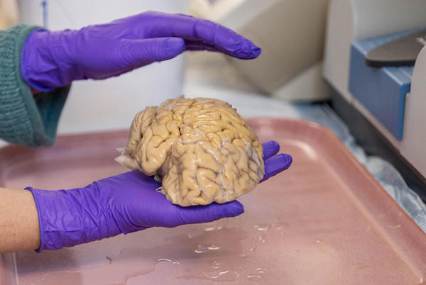 Cerebro