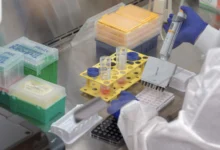 diana terapéutica - laboratorio