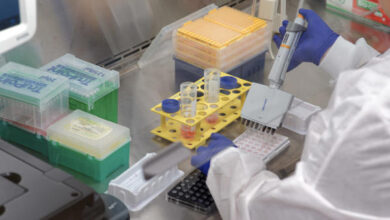 diana terapéutica - laboratorio