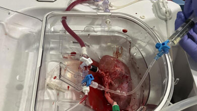 Trasplante riñón porcino