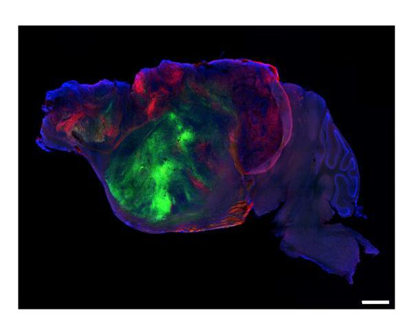 Cultivan tejido cerebral humano en modelos de ratón para el futuro estudio de enfermedades