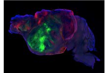 Cultivan tejido cerebral humano en modelos de ratón para el futuro estudio de enfermedades