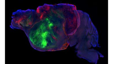 Cultivan tejido cerebral humano en modelos de ratón para el futuro estudio de enfermedades
